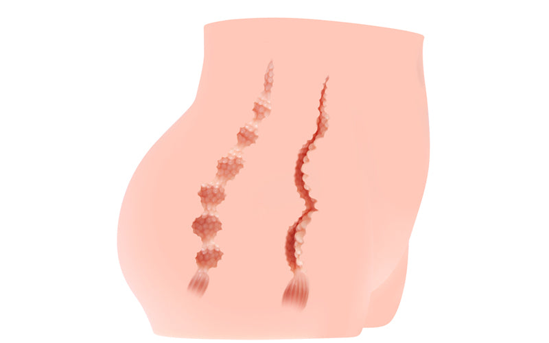 Real Hip Cherry Realistic Dual Orifice Pleasure Toy > Sex Toys For Men > Assbators
