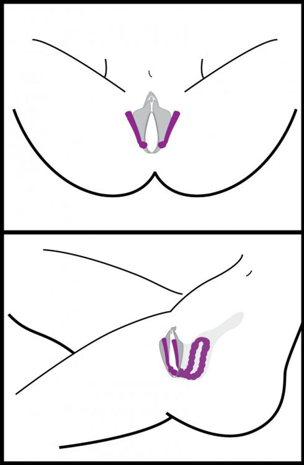 Oral Enhancing Hands Free Labia Spreader in Pink > Bondage Gear > Medical Instruments